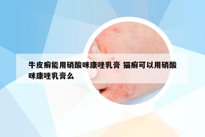 牛皮癣能用硝酸咪康唑乳膏 猫癣可以用硝酸咪康唑乳膏么