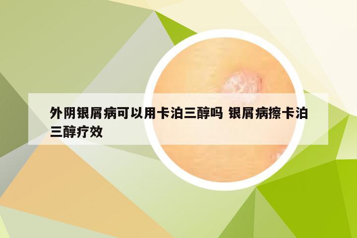 外阴银屑病可以用卡泊三醇吗 银屑病擦卡泊三醇疗效