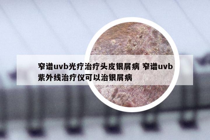 窄谱uvb光疗治疗头皮银屑病 窄谱uvb紫外线治疗仪可以治银屑病