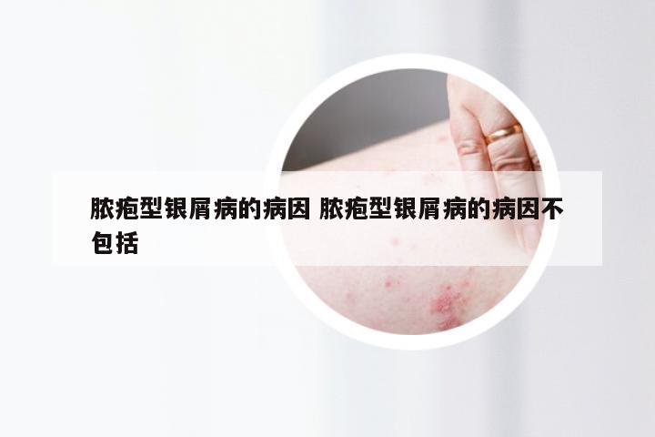 脓疱型银屑病的病因 脓疱型银屑病的病因不包括