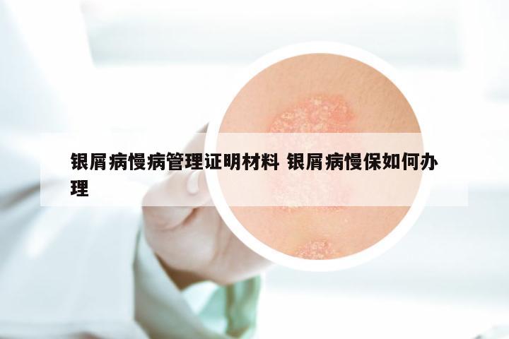 银屑病慢病管理证明材料 银屑病慢保如何办理