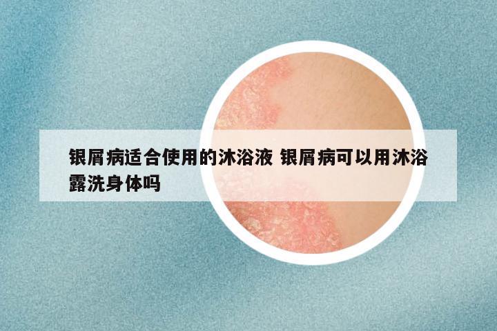 银屑病适合使用的沐浴液 银屑病可以用沐浴露洗身体吗