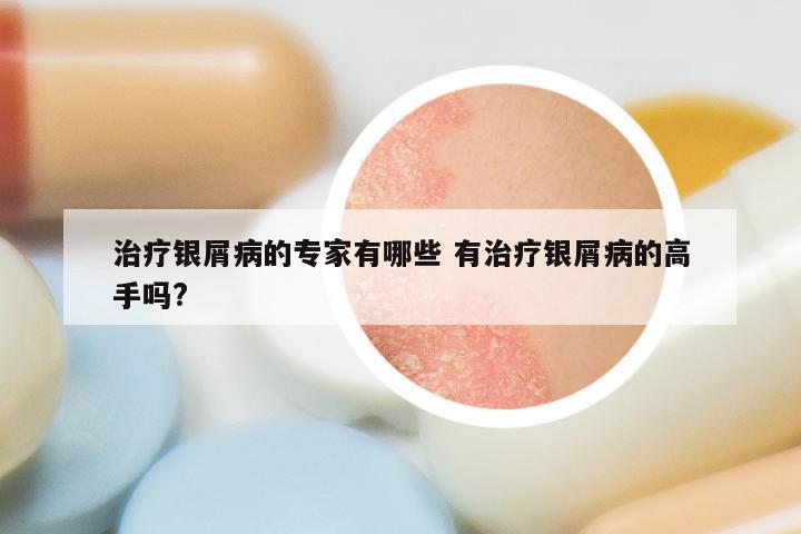 治疗银屑病的专家有哪些 有治疗银屑病的高手吗?