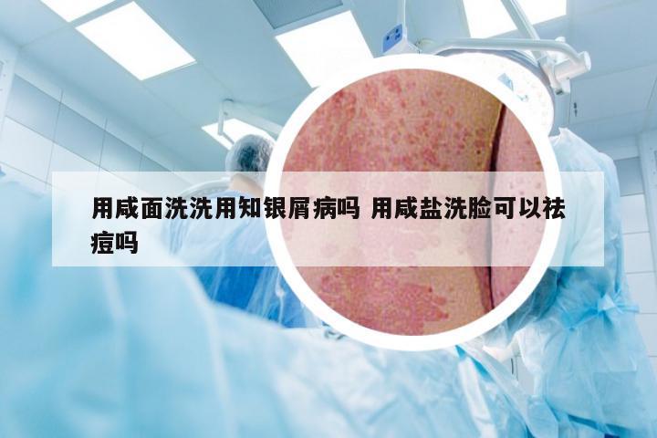 用咸面洗洗用知银屑病吗 用咸盐洗脸可以祛痘吗