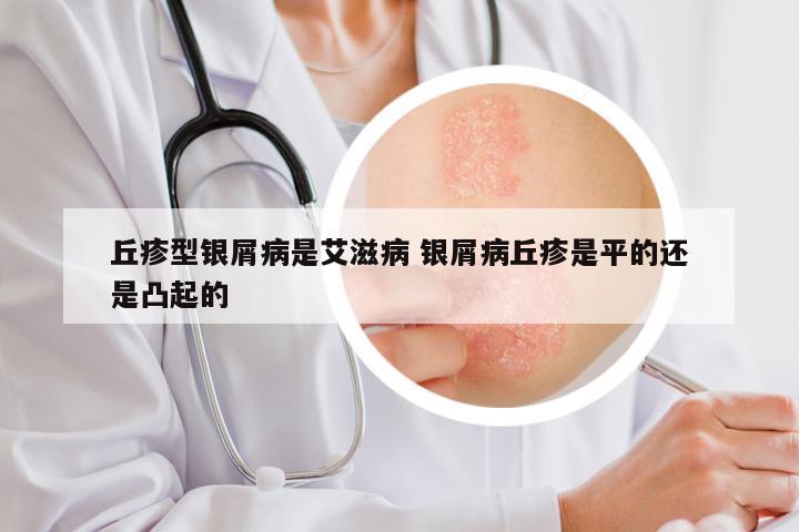 丘疹型银屑病是艾滋病 银屑病丘疹是平的还是凸起的