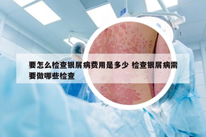 要怎么检查银屑病费用是多少 检查银屑病需要做哪些检查