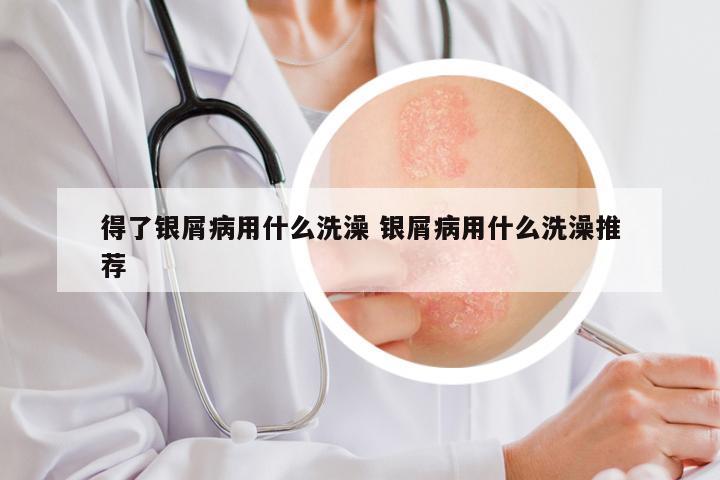 得了银屑病用什么洗澡 银屑病用什么洗澡推荐