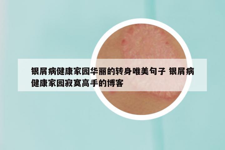 银屑病健康家园华丽的转身唯美句子 银屑病健康家园寂寞高手的博客