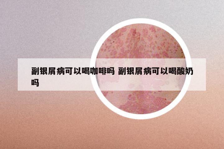 副银屑病可以喝咖啡吗 副银屑病可以喝酸奶吗