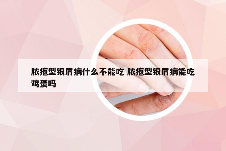 脓疱型银屑病什么不能吃 脓疱型银屑病能吃鸡蛋吗