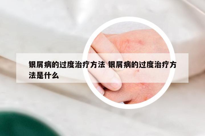 银屑病的过度治疗方法 银屑病的过度治疗方法是什么