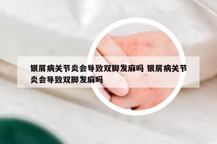 银屑病关节炎会导致双脚发麻吗 银屑病关节炎会导致双脚发麻吗