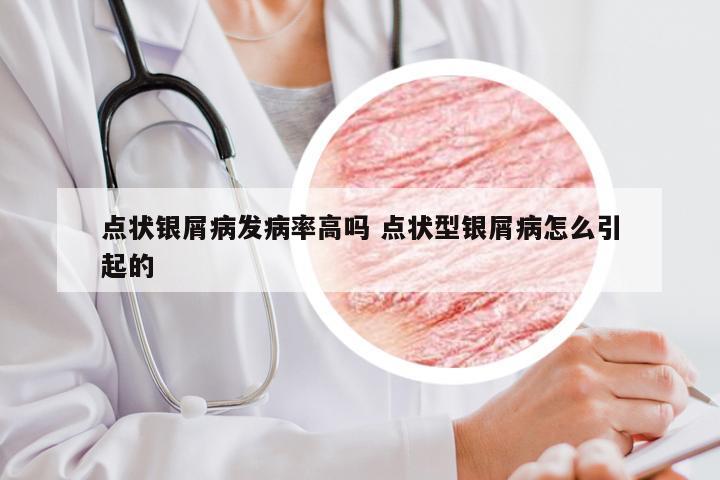 点状银屑病发病率高吗 点状型银屑病怎么引起的