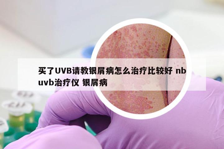 买了UVB请教银屑病怎么治疗比较好 nbuvb治疗仪 银屑病