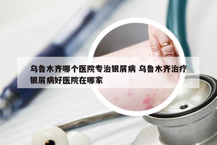 乌鲁木齐哪个医院专治银屑病 乌鲁木齐治疗银屑病好医院在哪家