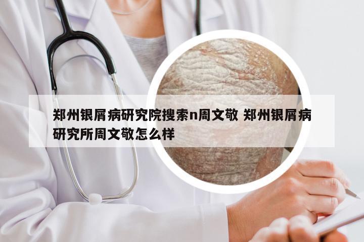 郑州银屑病研究院搜索n周文敬 郑州银屑病研究所周文敬怎么样