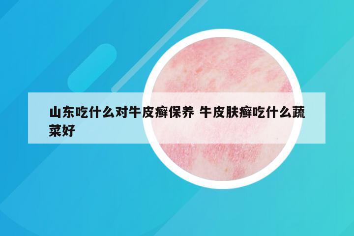 山东吃什么对牛皮癣保养 牛皮肤癣吃什么蔬菜好