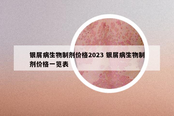 银屑病生物制剂价格2023 银屑病生物制剂价格一览表