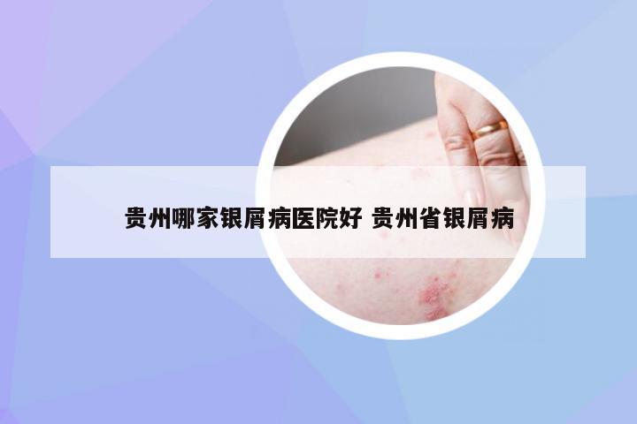 贵州哪家银屑病医院好 贵州省银屑病