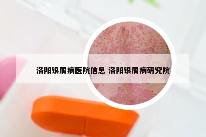 洛阳银屑病医院信息 洛阳银屑病研究院