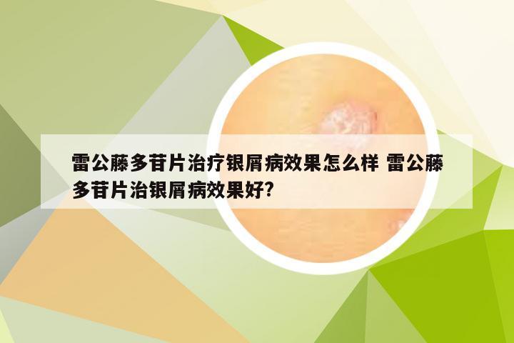 雷公藤多苷片治疗银屑病效果怎么样 雷公藤多苷片治银屑病效果好?