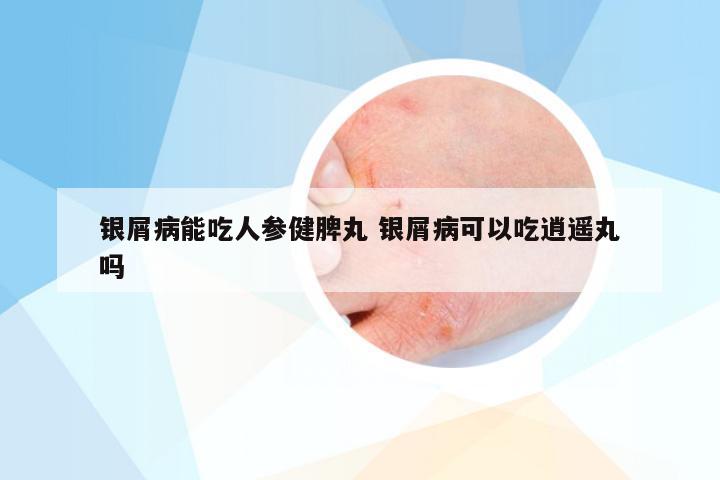 银屑病能吃人参健脾丸 银屑病可以吃逍遥丸吗