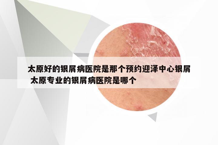 太原好的银屑病医院是那个预约迎泽中心银屑 太原专业的银屑病医院是哪个