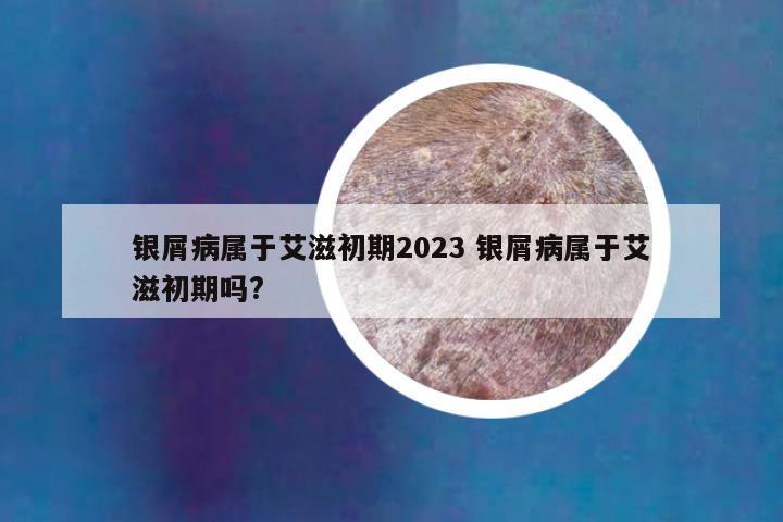 银屑病属于艾滋初期2023 银屑病属于艾滋初期吗?